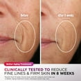 thumbnail image 8 of Shark CryoGlow Under-Eye Cooling + LED Anti-Aging & Skin Clearing Face Mask, 8 of 13