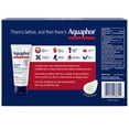 thumbnail image 2 of Aquaphor Advanced Therapy Healing Ointment, 1.75 oz., 4 pk., 2 of 4