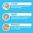 thumbnail image 5 of Neosporin Original First Aid Antibiotic Ointment 1 oz. tube + two .5 oz. tubes, 3 pk., 5 of 12