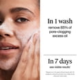 thumbnail image 4 of Neutrogena Evenly Clear Acne-Prone Skin Essentials Set, 4 of 9