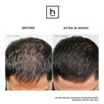 thumbnail image 7 of Hairmax Pro 12 LaserComb Hair Growth Bundle, 7 of 10