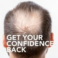 thumbnail image 8 of Member's Mark Minoxidil 5%, Hair Regrowth Treatment for Men, 2 fl. oz., 6 ct., 8 of 8