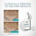thumbnail image 3 of RoC Hydration+ Serum & Moisturizer Duo Kit, 3 of 7