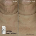 thumbnail image 4 of RoC Derm Correxion Firming Serum Stick and Contour Cream Kit, 4 of 6