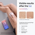 thumbnail image 3 of Braun IPL7 Silk-Expert Pro 7 Laser, Women's Hair Removal Kit, 3 of 6