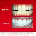 thumbnail image 4 of Colgate Optic White ComfortFit Teeth Whitening Kit, 4 of 9