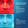 thumbnail image 6 of Navage Nasal Care Saline Nasal Irrigation Bundle, 6 of 8