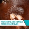 thumbnail image 6 of CeraVe Acne Cleanser + Blemish Patch Set, 6 of 14