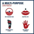 thumbnail image 7 of Aquaphor Advanced Therapy Healing Ointment Dual Pack, 7 of 9