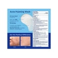 thumbnail image 2 of PanOxyl Acne Foaming Wash, 10% Benzoyl Peroxide, 5.5 oz., 2 pk., 2 of 6