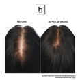 thumbnail image 8 of Hairmax Pro 12 LaserComb Hair Growth Bundle, 8 of 10