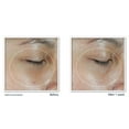 thumbnail image 4 of RoC Revive + Glow Vitamin C Cooling and Hydrating Eye Balm & Moisturizer, 4 of 7