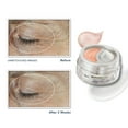 thumbnail image 3 of RoC Derm Correxion Dual Eye Cream & Fill + Treat Serum Kit, 3 of 8