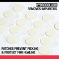 thumbnail image 5 of Neutrogena Stubborn Acne Blemish Patches, 24 ct., 3 pk., 5 of 7