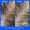 thumbnail image 6 of Head and Shoulders Pure Sport for Men's 2-in-1 Shampoo and Conditioner, 40 fl. oz., 6 of 10