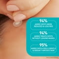 thumbnail image 13 of CeraVe Acne Cleanser + Blemish Patch Set, 13 of 14