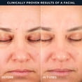 thumbnail image 9 of RoC Line Smoothing 2-Step Retinol Peel Pads, 36 ct., 9 of 10
