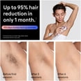 thumbnail image 5 of Braun IPL7 Silk-Expert Pro 7 Laser, Women's Hair Removal Kit, 5 of 10