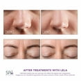 thumbnail image 5 of Spa Sciences LELA Skin Spatula, Choose Color, 5 of 9