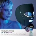 thumbnail image 4 of Shark CryoGlow Under-Eye Cooling + LED Anti-Aging & Skin Clearing Face Mask, 4 of 13