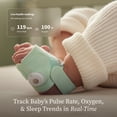 thumbnail image 4 of Owlet Dream Smart Bundle, Includes Dream Sock Monitor, Camera, and Travel Case, 4 of 6
