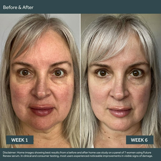 No7 Future Renew Damage Reversal Facial Serum Kit - Samsclub.com