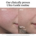 thumbnail image 6 of Neutrogena Ultra Gentle Daily Facial Moisturizer, 3.4 fl. oz., 2 pk., 6 of 8