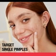 thumbnail image 6 of Neutrogena Stubborn Acne Blemish Patches, 24 ct., 3 pk., 6 of 7