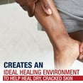 thumbnail image 8 of Aquaphor Advanced Therapy Healing Ointment Dual Pack, 8 of 9
