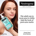 thumbnail image 3 of Neutrogena Evenly Clear Acne-Prone Skin Essentials Set, 3 of 9