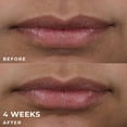 thumbnail image 7 of RoC Derm Correxion Lip Volumizer Duo, .34 fl. oz., 2 pk., 7 of 9