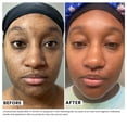 thumbnail image 5 of Urban Skin Rx 3-in-1 Even Tone Cleansing Bar 2 oz., 2 pk., 5 of 8