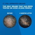 thumbnail image 5 of Men's Rogaine 5% Minoxidil Topical Hair Growth Treatment, 2 pack, 5 of 6
