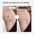 thumbnail image 2 of Ulike Air Max in Purple Home IPL Hair Removal Device, 2 of 5