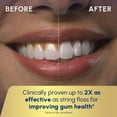 thumbnail image 9 of Waterpik Ultra Plus and Cordless Express Water Flosser, 9 of 9