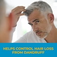 thumbnail image 6 of Nizoral Anti-Dandruff Shampoo with 1% Ketoconazole, Fresh Scent, 19 fl. oz., 6 of 10