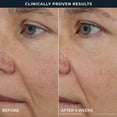 thumbnail image 9 of RoC Retinol Correxion Line Smoothing Triple Serum Duo, 1 fl. oz., 2 pk., 9 of 12