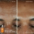 thumbnail image 2 of RoC Revive + Glow  Eye Balm and Daily Serum Brightening Kit, 2 of 6