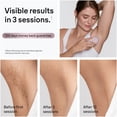 thumbnail image 5 of Braun IPL Silk-Expert Mini Laser, Hair Removal Kit, 5 of 9