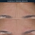 thumbnail image 10 of RoC Retinol Correxion Line Smoothing Triple Serum Duo, 1 fl. oz., 2 pk., 10 of 12