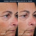 thumbnail image 8 of RoC Line Smoothing 2-Step Retinol Peel Pads, 36 ct., 8 of 10